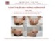 Bài giảng Điều dưỡng hồi sức cấp cứu: Chương 10 - ThS. BS. Nguyễn Phúc Học