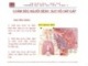 Bài giảng Điều dưỡng hồi sức cấp cứu: Chương 5 - ThS. BS. Nguyễn Phúc Học